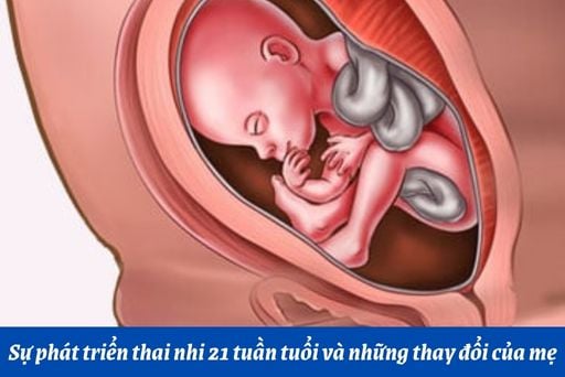 Thu Mua Đồ Cũ Thủ Dầu Một Giải pháp tối ưu cho nhu cầu thanh lý hàng hóa cũ